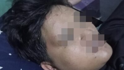 Serempetan Berujung Brutal, Pemuda Gatak Dianiaya dan Motor Dirusak di Jalan Ngestirejo