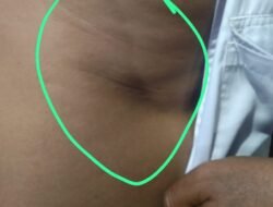 Pria 50 Tahun Diduga Dianiaya Sekelompok Pemuda di Pantai Sarangan, Polisi Lakukan Penyelidikan